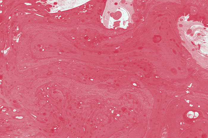 Marmormorierung mit weissen Blubberflecken auf rotem Hintergrund